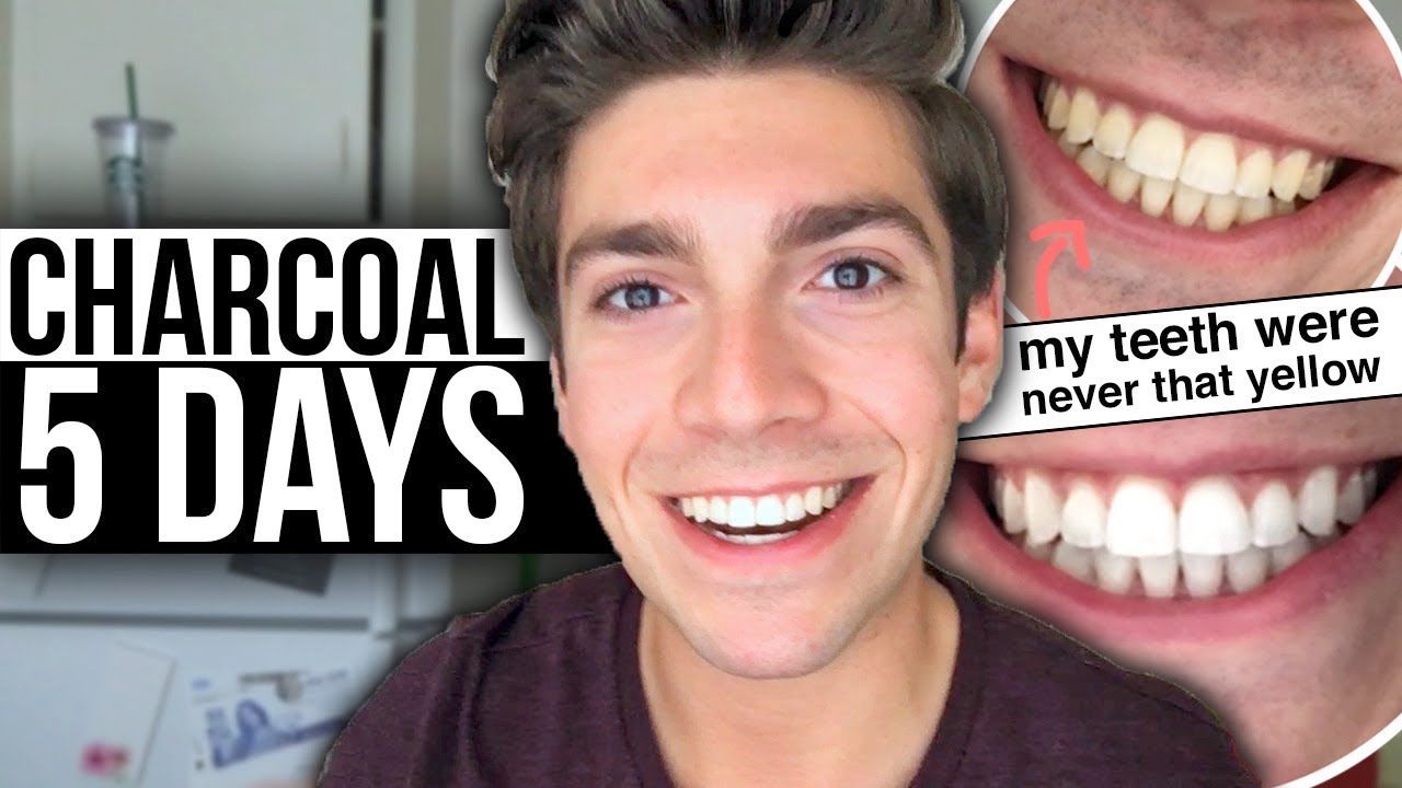5 Days with ACTIVATED CHARCOAL! Failed Experiment... | david prater ...
