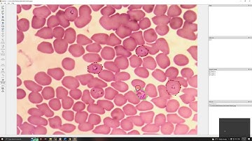 Malaria Life-Cycle Classification Data Labelling via labelme