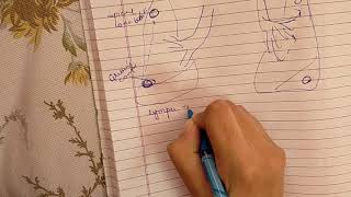 Tuberculosis Pathology  Part 3 Secondary Tuberculosis