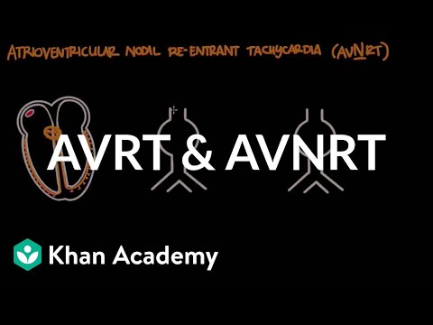 Atrioventricular reentrant tachycardia (AVRT) & AV nodal reentrant tachycardia (AVNRT)