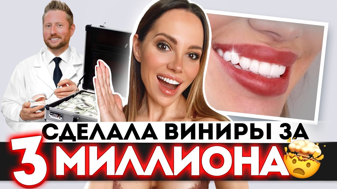 ГОЛЛИВУДСКАЯ УЛЫБКА! ЗУБЫ МЕЧТЫ!)))