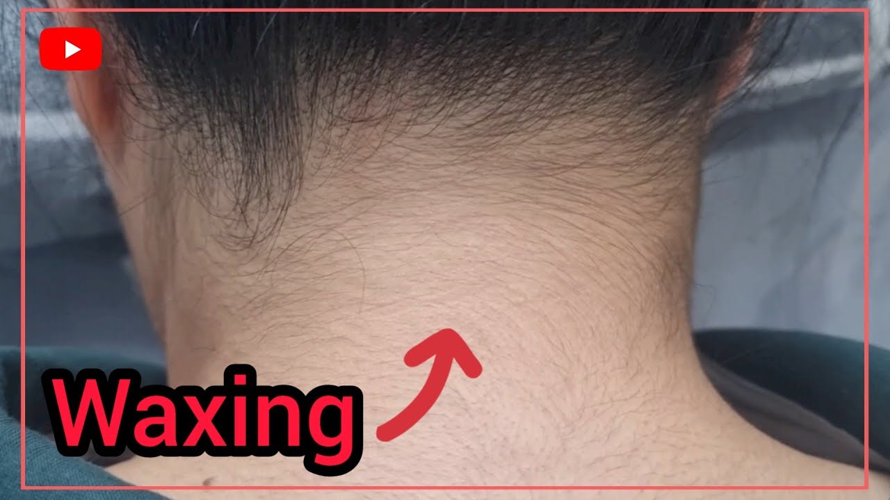 (순삭왁싱) 뒷목라인 깔끔하게 없애기 Waxing removes hair on the back of the neck