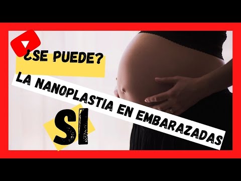 Nanoplastia En Embarazadas on Sale, UP TO 65% OFF | agrichembio.com
