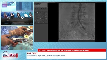 BEC 2021 | LIVE CASE | Acibadem City Clinic Cardiovascular Center
