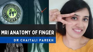 MRI ANATOMY OF FINGER | DR CHAITALI PAREKH | FINGER PULLEYS | REPORTING CHECKLIST