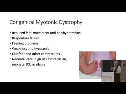 Video: Ist Myotonia congenita erblich?