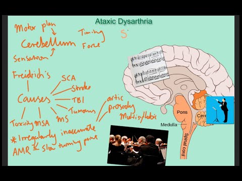 Ataxic dysarthria - tutorial with examples