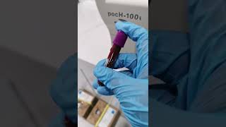 Life inside the Laboratory #medtechlife #laboratorylife #blood #chemistry #hematology