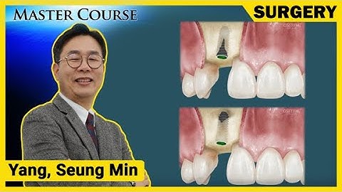 [Master Course Season2 - SURGERY] Introduction - Classification & Treatment of Bone Defects
