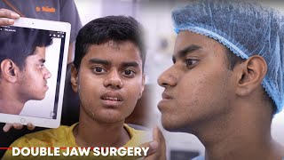 Double Jaw Surgery | Changing this Young Boys Face | 7 Days Follow up