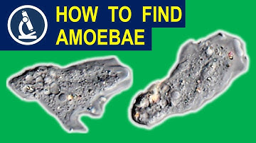 Where and how you can find AMOEBAE for your microscope 🔬 174