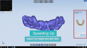 Impression Scan with Bite Record Shining 3D Autoscan-DS-EX dental scanner