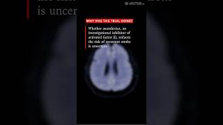 Asundexian for Secondary Stroke Prevention (OCEANIC-STROKE)