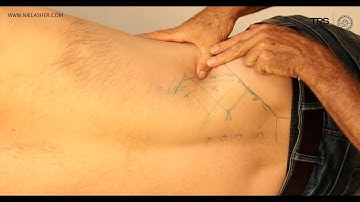 Trigger Point Release for Back Pain: Quadratus Lumborum (QL)