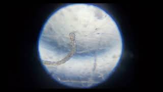 What is the hair on the aeolosoma for ? by WITH3Я 9 views 8 months ago 2 minutes, 11 seconds