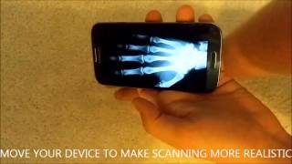 X-ray body scanner simulator for ANDROID screenshot 4