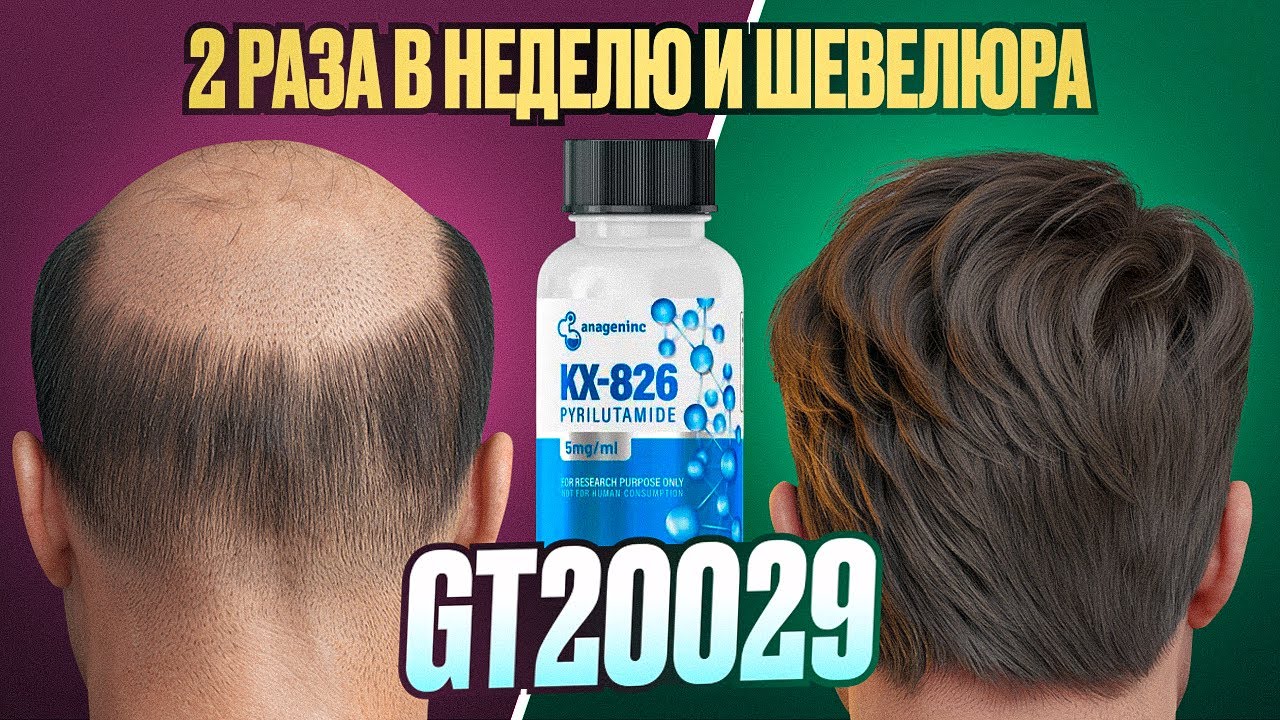 GT20029 уже на рынке? Стоит ли ждать революцию?