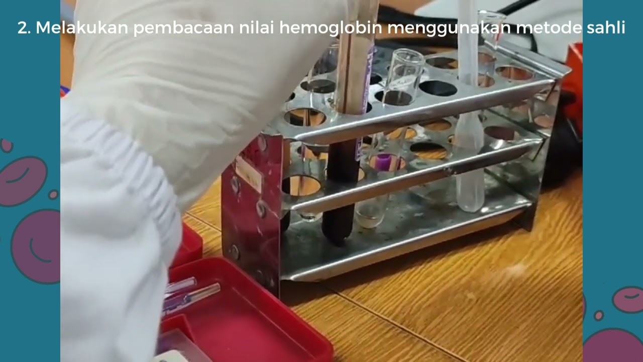 PEMERIKSAAN INDEKS ERITROSIT METODE MANUAL