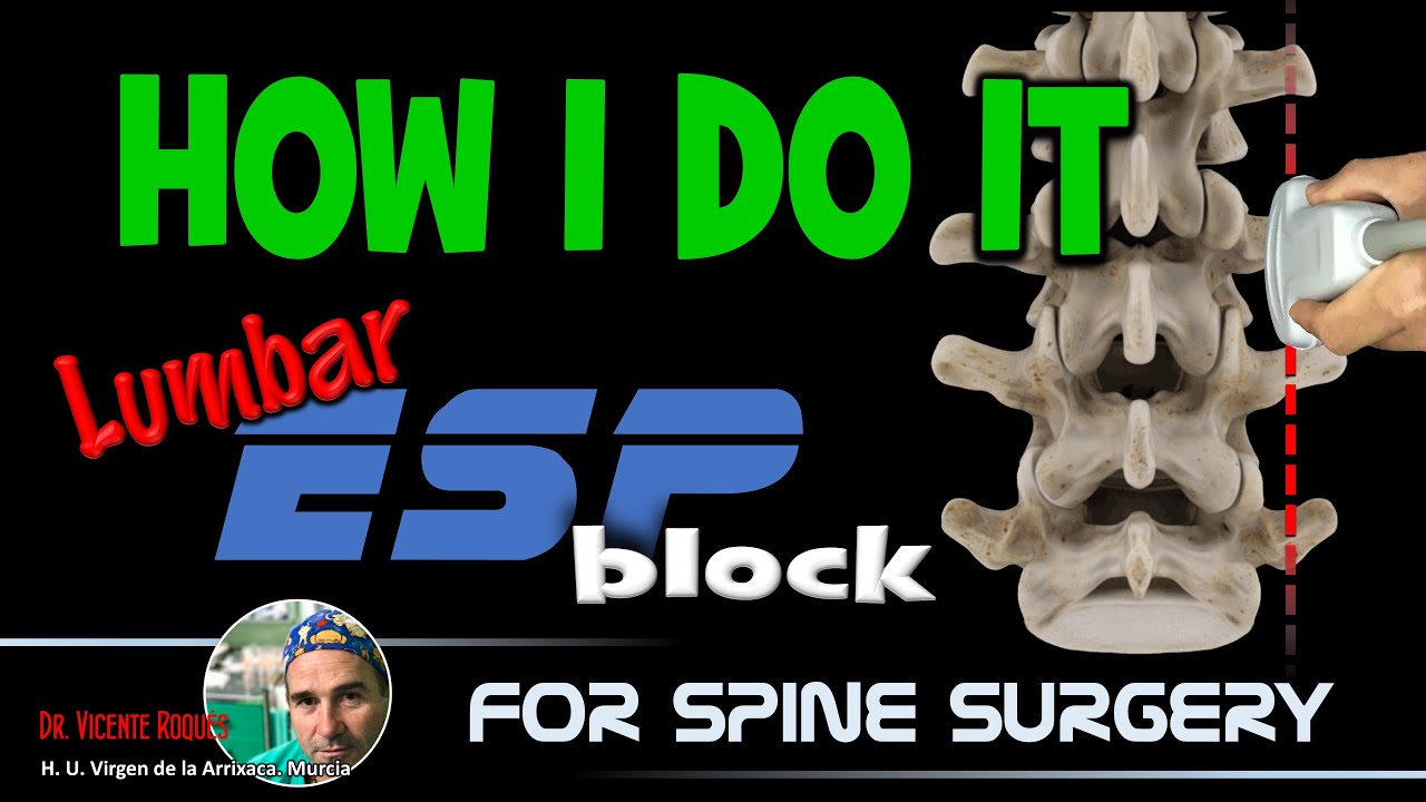 LUMBAR ESP FOR SPINE SURGERY camera iphone 8 plus apk