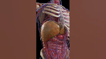 From Fatty Liver To Cirrhosis 