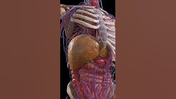 Thumbnail of From Fatty Liver to Cirrhosis