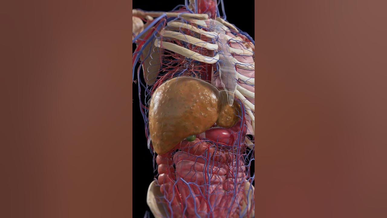 From Fatty Liver to Cirrhosis