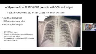 Making Sense of the COVID-19 Data in Persons with HIV screenshot 5