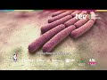 Adipozytäre und fibroblastische Tumoren in der Pathologie
