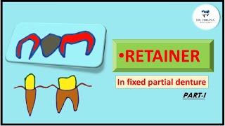 #drchhaya RETAINERS in fixed partial denture fpd (PART-1)•Classification•full and partial coverage