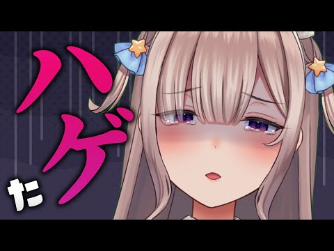【悲報】ハゲたから病院に行ってきた【体験レポ】