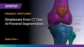 Simpleware Knee CT Tool - AI-Powered Segmentation