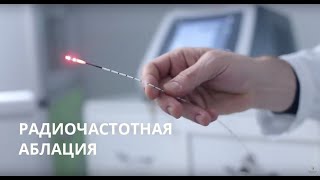 Радиочастотная аблация