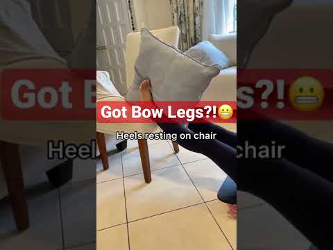 Video: Bow legged menyebabkan masalah?