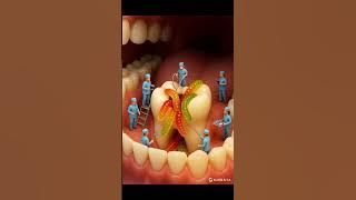 Sakit gigi, eh taunya ada permen viral #animasilucu #miniworkers #permenviral #ai #shorts