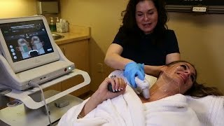Video Ad | Ultherapy 30 Second Version | VSP Healthcare