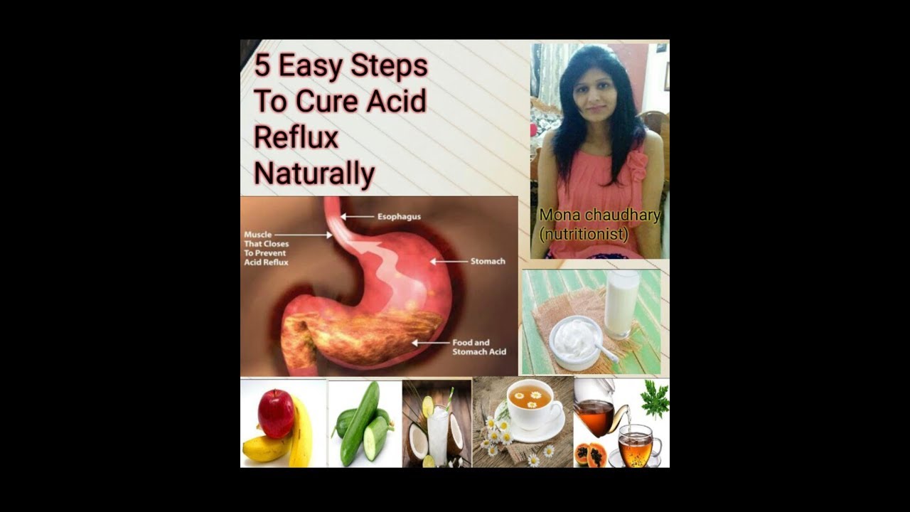 How To Get Rid Of Acidity Home Remedies Natural Tips For Gastric How To Get Rid Of Acidity Home Remedies Natural Tips For Gastric