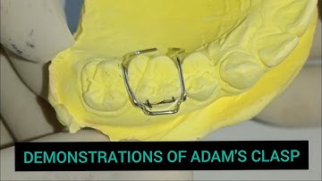 #Adam