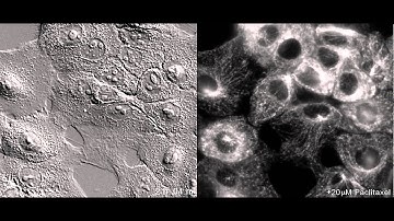 Paclitaxel effect on RFP-α-tubulin in MCF10A cells: endogenous gene tagging by ZFNs