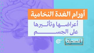 الصحية | أورام الغدة النخامية.. أعراضها وتأثيرها على الجسم | 2021-04-25