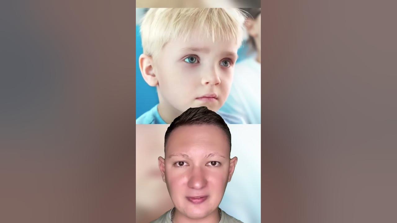 Звездочка пацаны до и после операции Мальчик попросил последнее желание перед операцией - YouTube