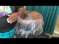 How to cover a large bald spot| Alopecia Extensions|