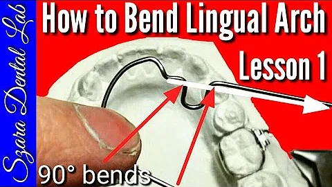 Wire Bending Lesson Lingual Arch #1