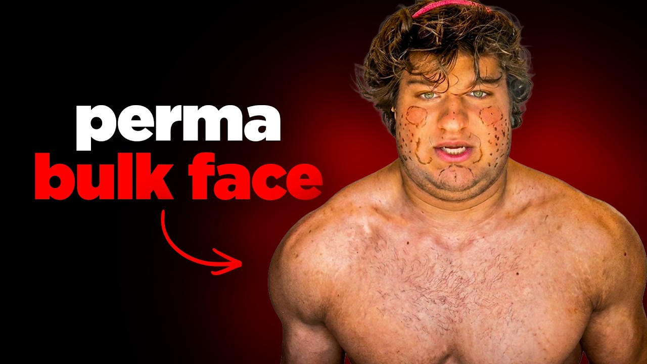 He Injected Acid Into His Face...