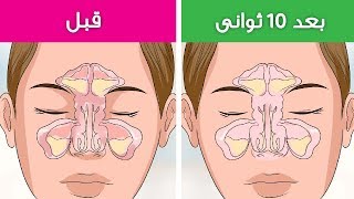 علاج انسداد الانف والتهاب الجيوب الانفية فى 30 ثانية فقط