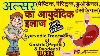 अल्सर का गारेंटेड आयुर्वेदिक उपचार || Ayurvedic treatment of Ulcers || Gastric,Peptic, Duodenal ||