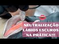 Neutralizao labial na prtica com nanda gamma