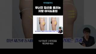 무너진 힙선을 다시 올리는 방법! 지방이식&amp;흡입 #지방흡입후기