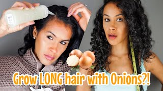 HOW TO GROW YOUR HAIR, REDUCE SHEDDING &amp; TREAT DANDRUFF WITH ONION JUICE