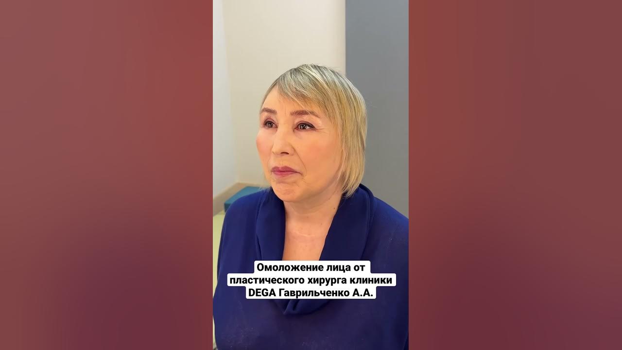Клиника дега юсупова результаты фото Омоложение лица от пластического хирурга клиники DEGA Гаврильченко А.А.❤ 