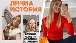 НОВА УСМИВКА? ПОЛЕЗНИ съвети за лечение, алайнери и фасети